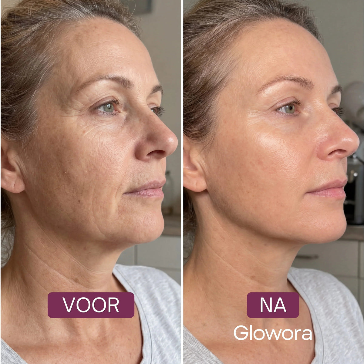 Slappe Hals Bio-Collageen Masker