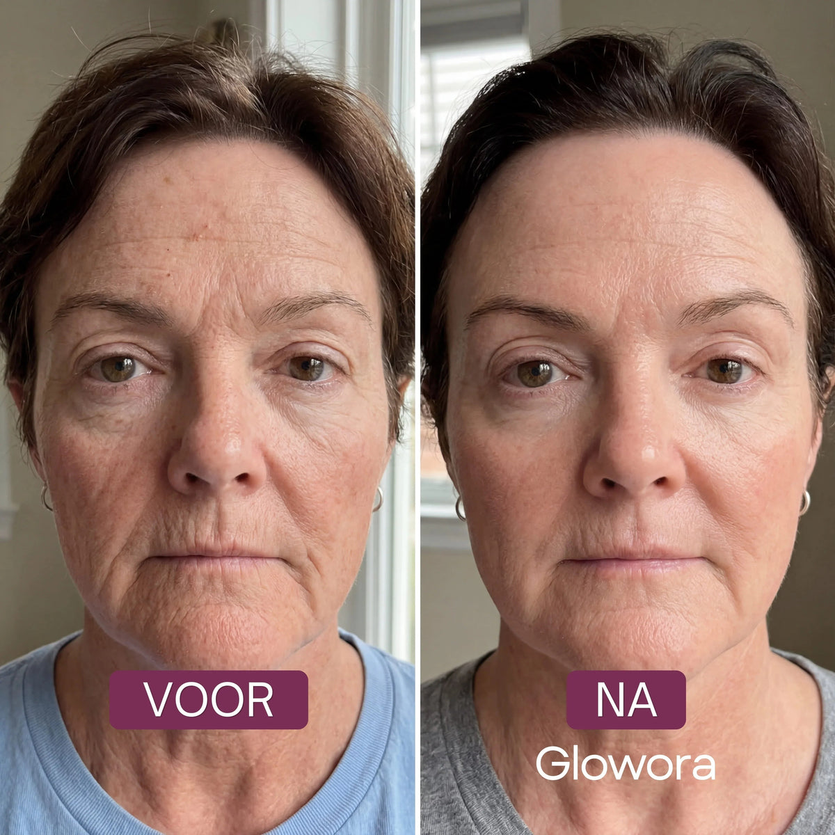 Slappe Hals Bio-Collageen Masker