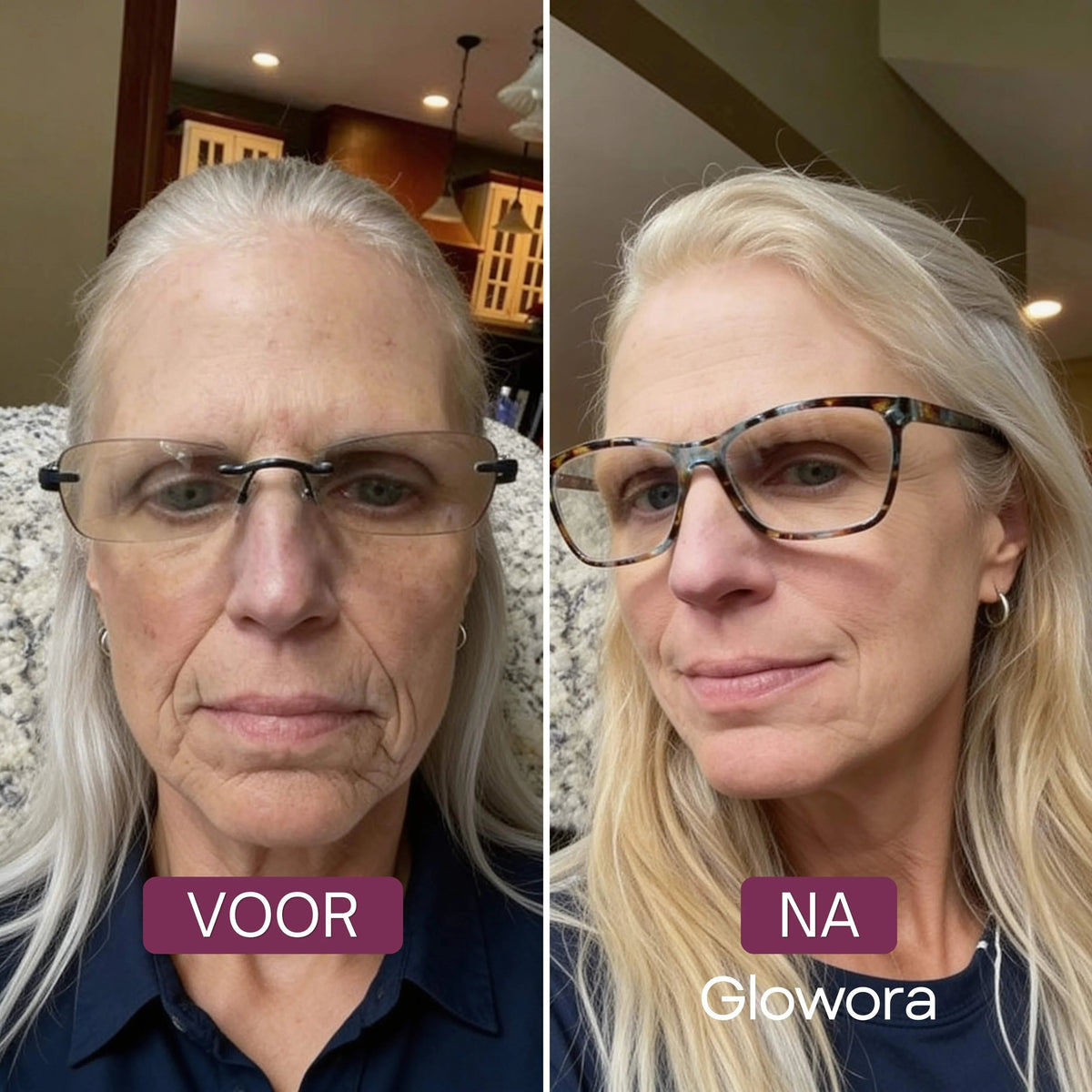 Anti-Aging Set